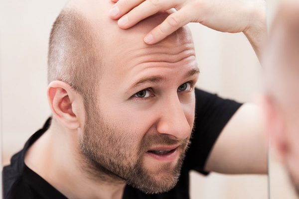Caída del cabello por causas endocrinas y nutricionales
